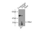 TPM3 Antibody in Immunoprecipitation (IP)
