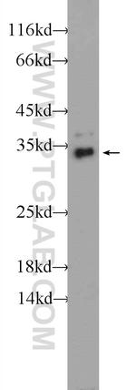 TPM3 Antibody in Western Blot (WB)