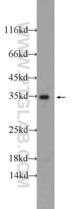 TPM3 Antibody in Western Blot (WB)
