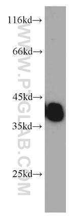 TPM3 Antibody in Western Blot (WB)