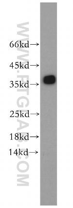 TPM3 Antibody in Western Blot (WB)