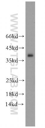 TPM3 Antibody in Western Blot (WB)