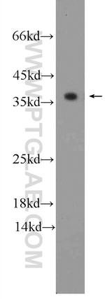 TPM3 Antibody in Western Blot (WB)