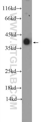 TPM3 Antibody in Western Blot (WB)