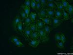 VAMP4 Antibody in Immunocytochemistry (ICC/IF)