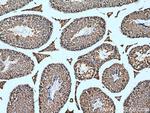 RTN4/NOGO Antibody in Immunohistochemistry (Paraffin) (IHC (P))