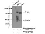 DTNA Antibody in Immunoprecipitation (IP)