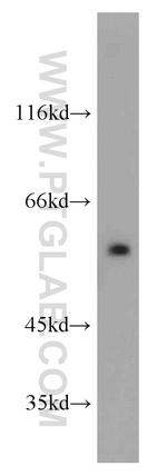 DTNA Antibody in Western Blot (WB)