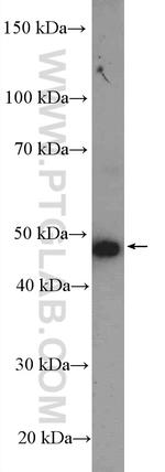 DTNA Antibody in Western Blot (WB)
