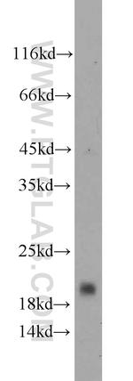 CD59 Antibody in Western Blot (WB)