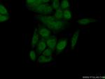 Centromere protein R Antibody in Immunocytochemistry (ICC/IF)