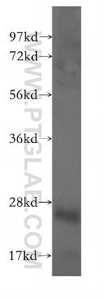 Centromere protein R Antibody in Western Blot (WB)