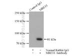 MRE11 Antibody in Immunoprecipitation (IP)