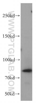 MRE11 Antibody in Western Blot (WB)