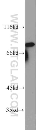 MRE11 Antibody in Western Blot (WB)