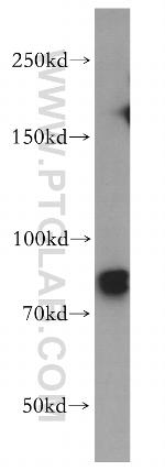 MRE11 Antibody in Western Blot (WB)