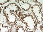 LKB1 Antibody in Immunohistochemistry (Paraffin) (IHC (P))