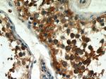 LKB1 Antibody in Immunohistochemistry (Paraffin) (IHC (P))