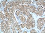 LKB1 Antibody in Immunohistochemistry (Paraffin) (IHC (P))