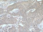 LKB1 Antibody in Immunohistochemistry (Paraffin) (IHC (P))