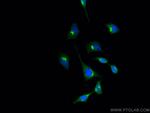 GRASP65/GORASP1 Antibody in Immunocytochemistry (ICC/IF)