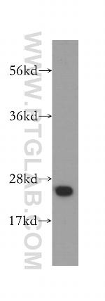 DARPP32 Antibody in Western Blot (WB)