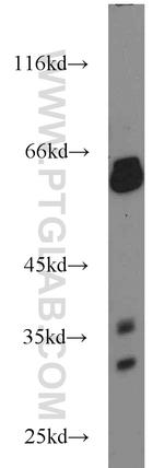 UCP3 Antibody in Western Blot (WB)