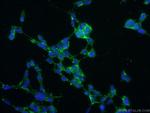 NIPSNAP3A Antibody in Immunocytochemistry (ICC/IF)