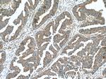 NIPSNAP3A Antibody in Immunohistochemistry (Paraffin) (IHC (P))