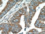 NIPSNAP3A Antibody in Immunohistochemistry (Paraffin) (IHC (P))
