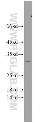 NIPSNAP3A Antibody in Western Blot (WB)