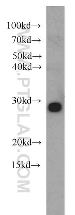 NIPSNAP3A Antibody in Western Blot (WB)