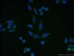 CNOT8 Antibody in Immunocytochemistry (ICC/IF)