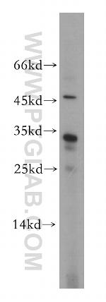 CNOT8 Antibody in Western Blot (WB)