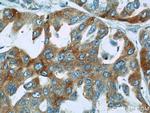 PTGDS Antibody in Immunohistochemistry (Paraffin) (IHC (P))