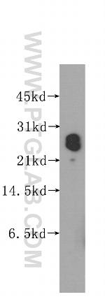 PTGDS Antibody in Western Blot (WB)