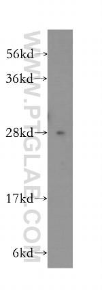 PTGDS Antibody in Western Blot (WB)