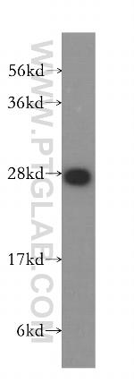 PTGDS Antibody in Western Blot (WB)