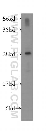 PTGDS Antibody in Western Blot (WB)