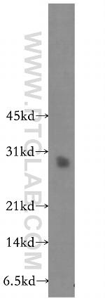 PTGDS Antibody in Western Blot (WB)