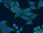 HADHA Antibody in Immunocytochemistry (ICC/IF)