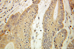 HADHA Antibody in Immunohistochemistry (Paraffin) (IHC (P))