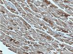 HADHA Antibody in Immunohistochemistry (Paraffin) (IHC (P))