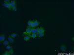 Secretogranin V Antibody in Immunocytochemistry (ICC/IF)