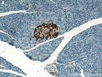 Secretogranin V Antibody in Immunohistochemistry (Paraffin) (IHC (P))
