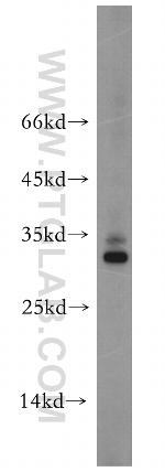 Secretogranin V Antibody in Western Blot (WB)