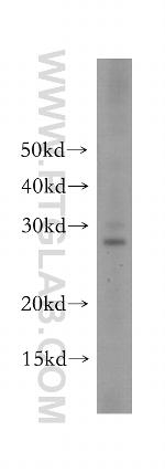 Secretogranin V Antibody in Western Blot (WB)