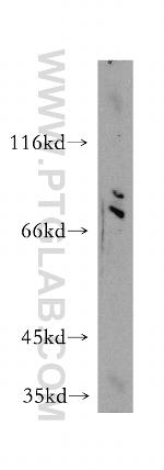 GSPT1 Antibody in Western Blot (WB)