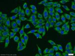 HPS3 Antibody in Immunocytochemistry (ICC/IF)