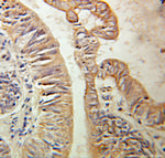 HPS3 Antibody in Immunohistochemistry (Paraffin) (IHC (P))